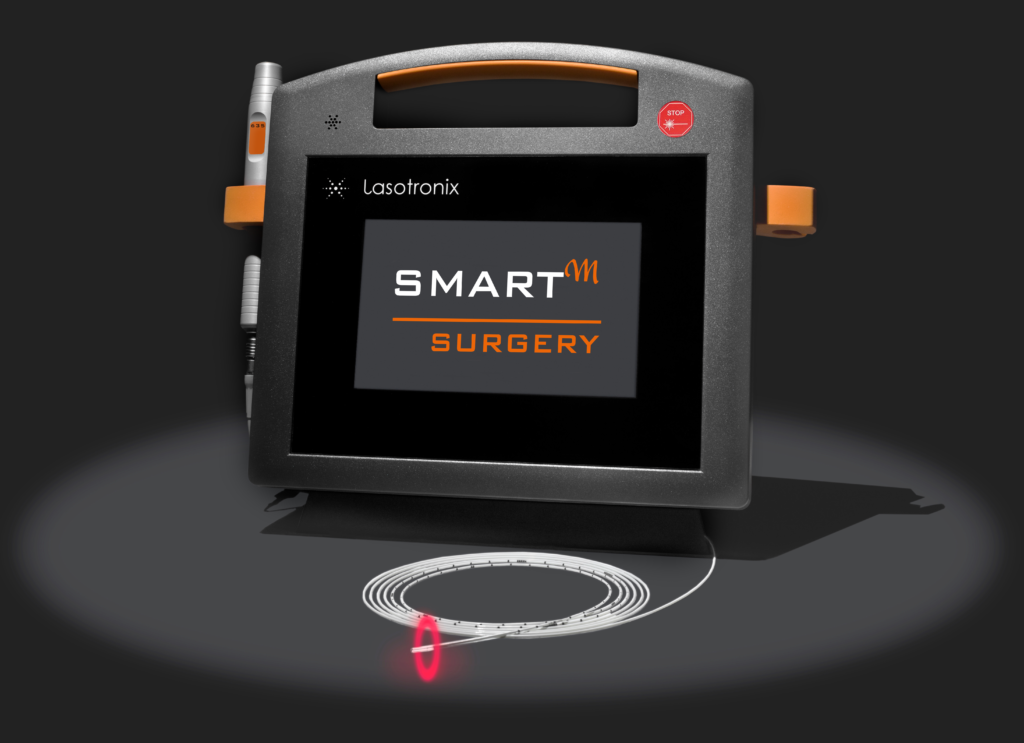 SMART M SG 1