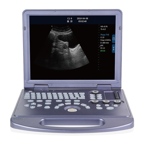 DW-360_laptop_black_and_white_ultrasound_machine