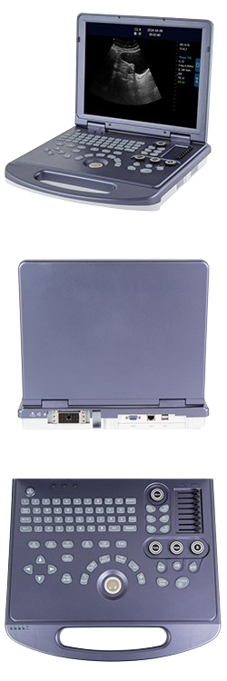 DW-360 laptop black and white ultrasound machine