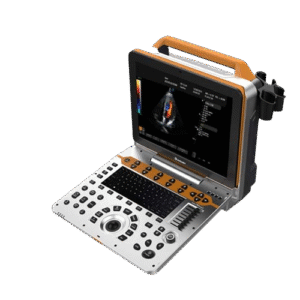 DW-P60(P8Lite) Best Portable medical cardiac ultrasound scanner machine(Echo machine)
