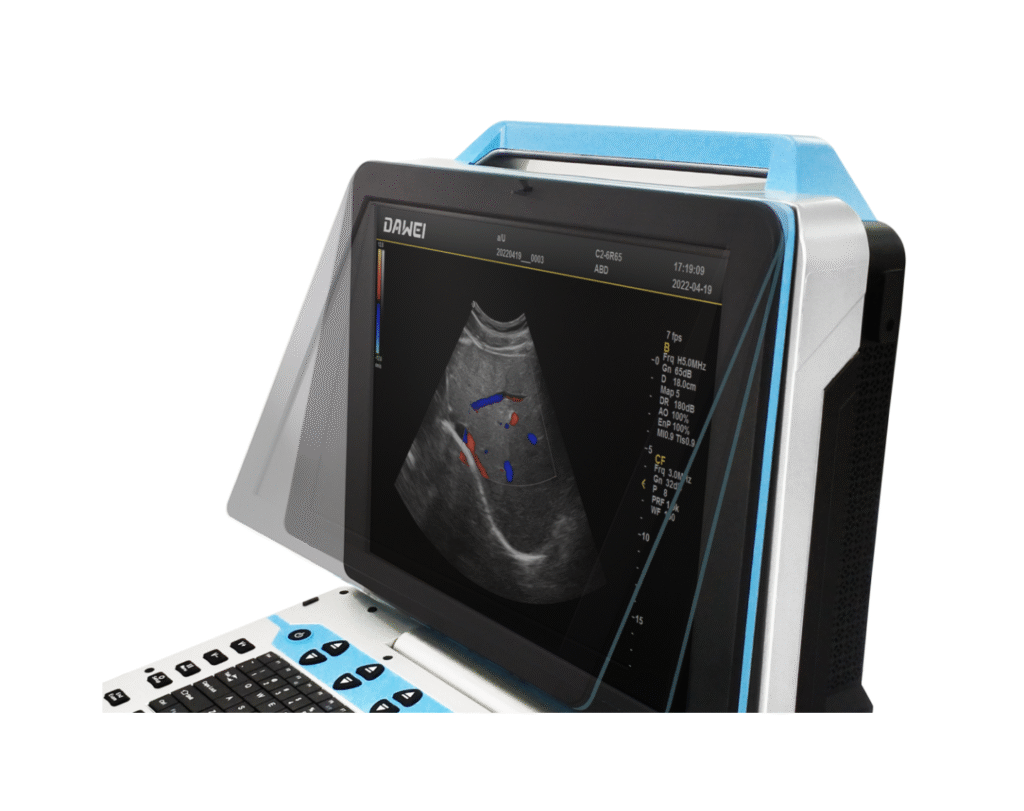 Portable Color Doppler Ultrasound System R