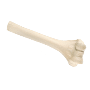 Structural Allografts