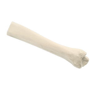 Structural Allografts1