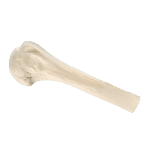 Structural Allografts2