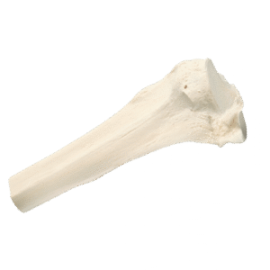 Structural Allografts3