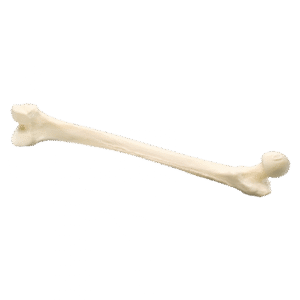 Structural Allografts4