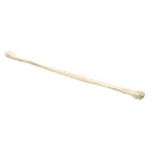 Structural Allografts5