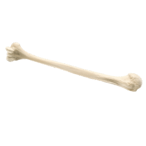 Structural Allografts6
