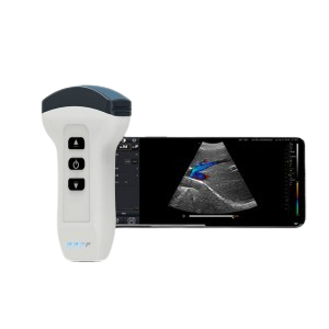 Wireless Handheld Ultrasound Scanner