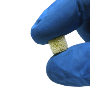 bone particulates