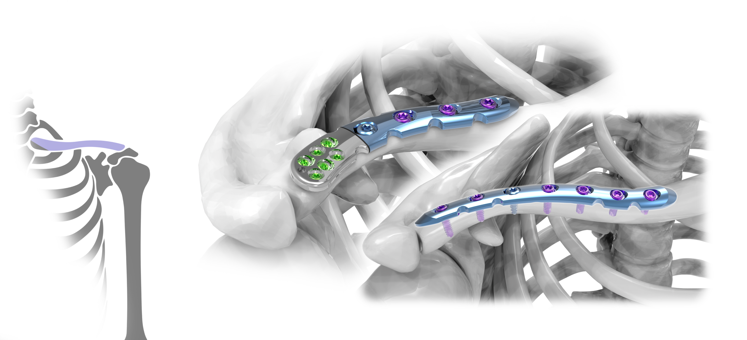 Clavicle 2,7 / 3,5mm