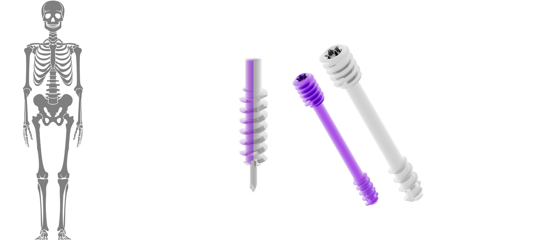 Compression 2,5 | 3,0mm