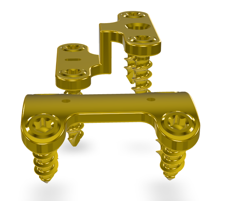 Screenshot 2026-03-06 171130